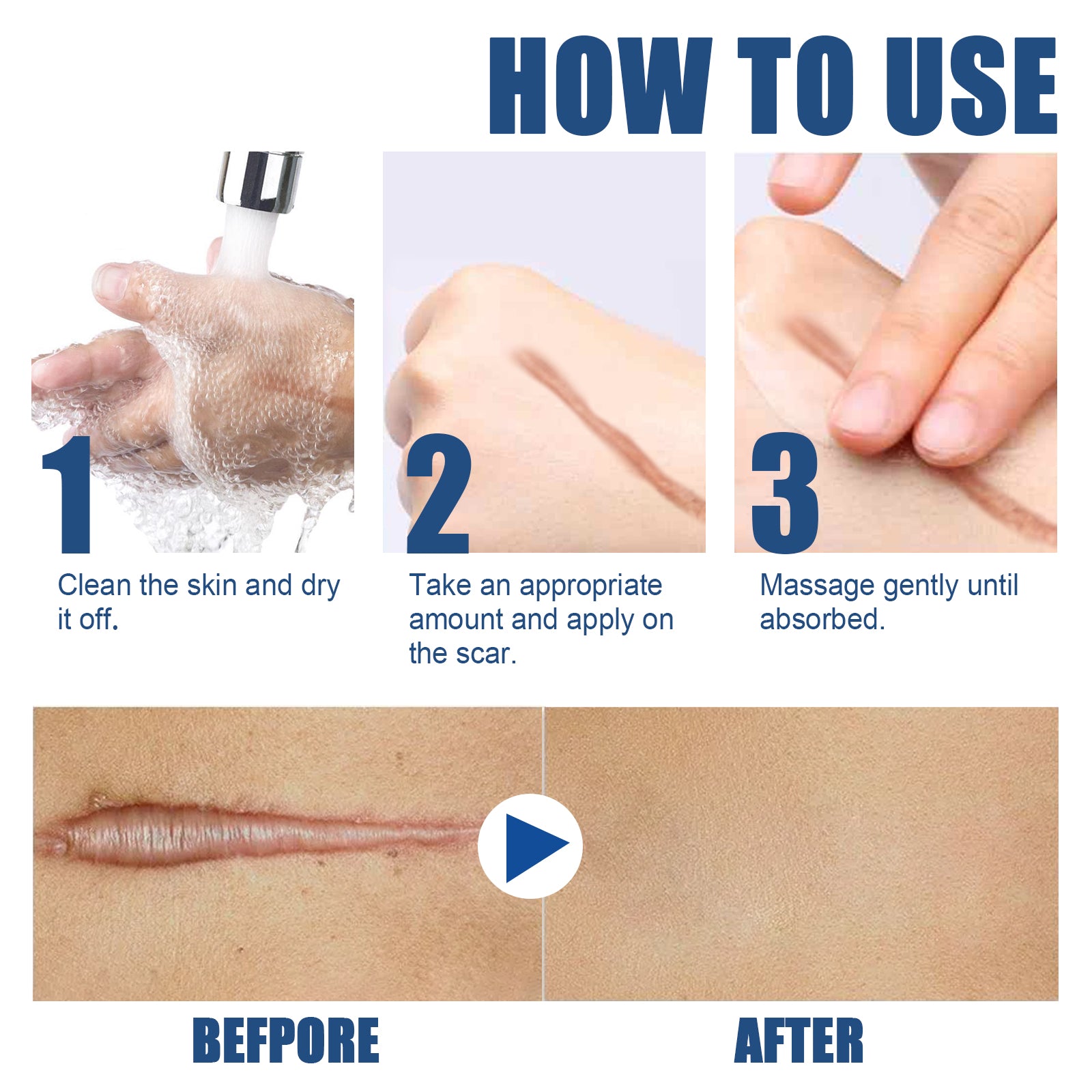 EELHOE Skin Care Cream Gentle Care External Body Care Moisturizing Smooth Skin Care Cream